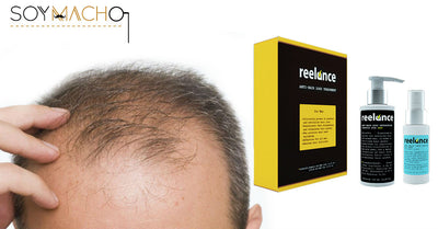 Como eliminar la alopecia androgénica